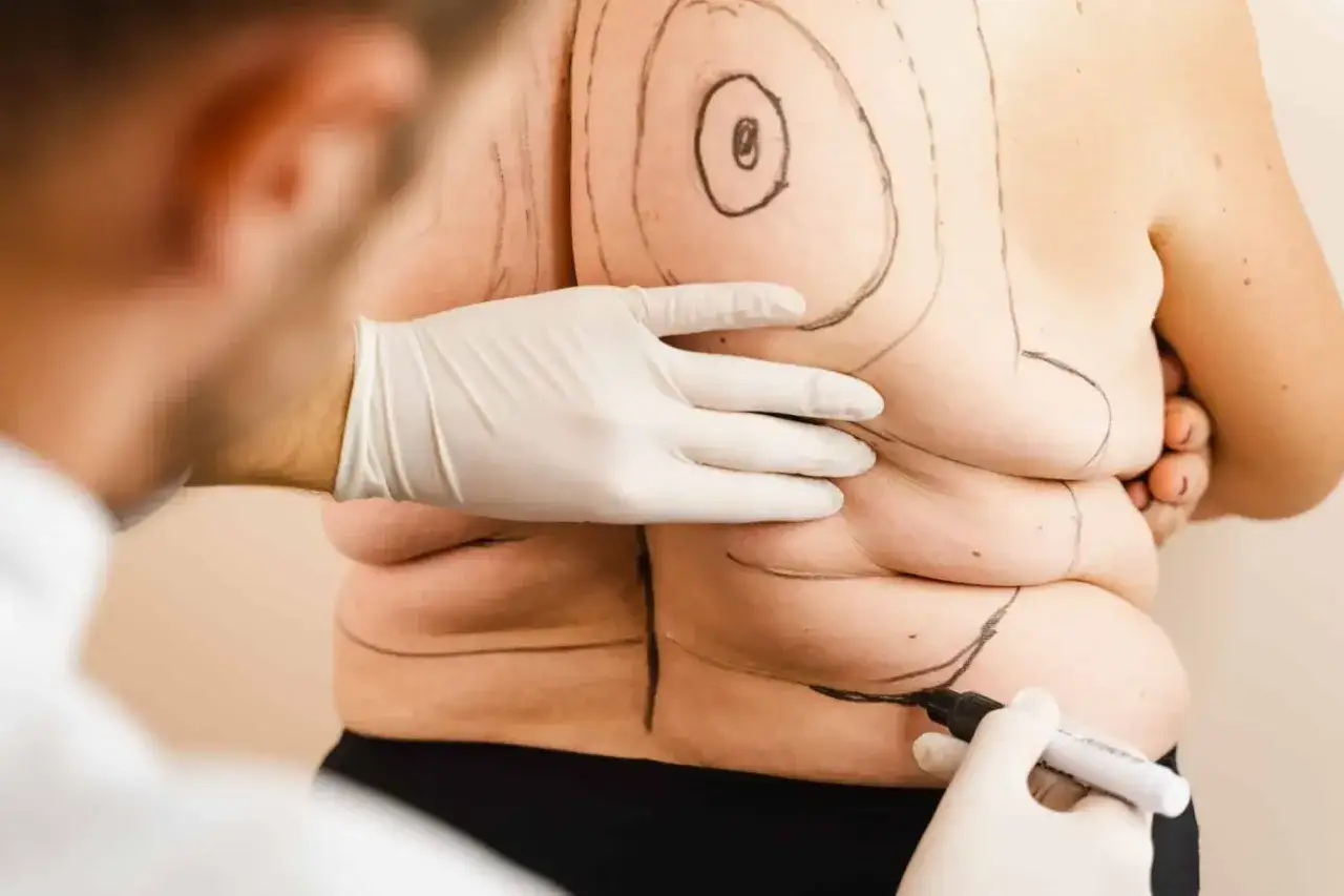 Liposukcja laserowa: jak trwale usunąć tłuszcz i ujędrnić skórę?